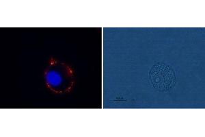 Expression of mGluR1 in rat C6 glioma cells - Cell surface detection of mGluR1 in live intact rat C6 glioma cells using Anti-mGluR1 (extracellular) Antibody (ABIN7043245, ABIN7044330 and ABIN7044331), (1:100), followed by goat-anti-rabbit-AlexaFluor-555 secondary antibody (red).