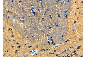 ABIN6265218 and ABIN6277933 at 1/100 staining Mouse brain tissue by IHC-P. (SOD3 anticorps  (Internal Region))