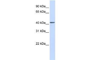 WB Suggested Anti-NOB1 Antibody Titration: 0. (NOB1 anticorps  (C-Term))