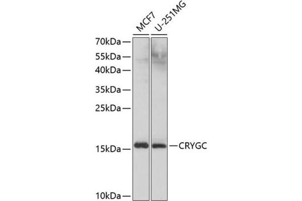 CRYGC Antikörper  (AA 1-174)