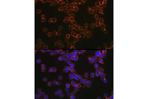 anti-CD209 (CD209) (AA 265-404) antibody