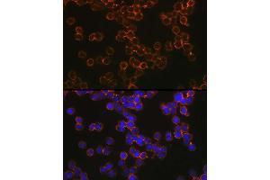 Immunofluorescence analysis of U-937 cells using CD209 Rabbit pAb (ABIN1679076, ABIN5663916, ABIN5663918 and ABIN6218556) at dilution of 1:100 (40x lens). (DC-SIGN/CD209 anticorps  (AA 265-404))