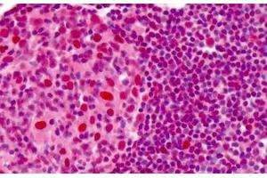 Human Tonsil: Formalin-Fixed, Paraffin-Embedded (FFPE)