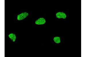 Immunofluorescence of monoclonal antibody to MSX2 on HeLa cell. (Msx2/Hox8 anticorps  (AA 101-201))