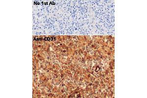 Immunohistochemistry (IHC) image for anti-Platelet/endothelial Cell Adhesion Molecule (PECAM1) (C-Term) antibody (ABIN6254202)