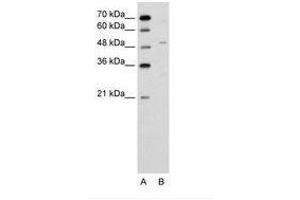Image no. 1 for anti-Zinc Finger Protein 19 (ZNF19) (AA 51-100) antibody (ABIN6736634) (ZNF19 anticorps  (AA 51-100))