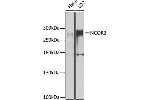 Western blot analysis of extracts of various cell lines, using NCOR2 antibody (ABIN6130575, ABIN6144422, ABIN6144423 and ABIN6224431) at 1:1000 dilution. (NCOR2 anticorps  (AA 670-900))