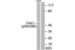 Western blot analysis of extracts from K562 cells treated with Na3VO4 0. (CHEK1 anticorps  (pSer286))