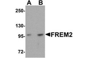 Western blot analysis of FREM2 in A-20 cell lysate with FREM2 antibody at (A) 0. (FREM2 anticorps  (Center))