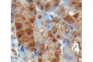 Used in DAB staining on fromalin fixed paraffin-embedded Kidney tissue (Adrenomedullin anticorps  (AA 24-171))