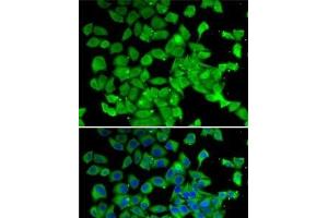 Immunofluorescence analysis of MCF7 cells using PARN Polyclonal Antibody (PARN anticorps)