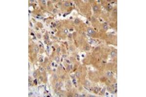 Formalin fixed and paraffin embedded human liver tissue reacted with GGH Antibody (N-term) followed by peroxidase conjugation of the secondary antibody and DAB staining. (GGH anticorps  (N-Term))