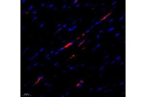 Immunofluorescence of paraffin embedded rat heart using MTND5 (ABIN7074659) at dilution of 1: 400 (400x lens)