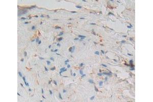 Used in DAB staining on fromalin fixed paraffin- embedded Kidney tissue (PCM1 anticorps  (AA 1913-2024))
