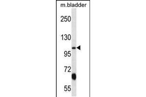 Western blot analysis in mouse bladder tissue lysates (35ug/lane).