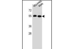 LRRC6 Antibody (Center) (ABIN655700 and ABIN2845153) western blot analysis in NCI-,A549 cell line lysates (35 μg/lane). (LRRC6 anticorps  (AA 179-207))