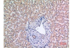 Immunohistochemistry (IHC) analysis of paraffin-embedded Human Liver, antibody was diluted at 1:100.