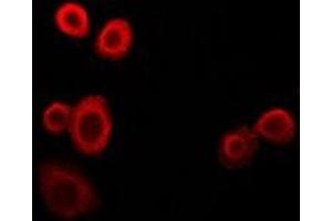 Immunofluorescent analysis of NDUFS4 staining in HepG2 cells. (NDUFS4 anticorps)
