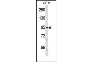 Western blot analysis of FAM38B Antibody (C-term) in CEM cell line lysates (35ug/lane). (PIEZO2 anticorps  (C-Term))
