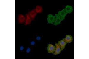 ABIN6258641 and ABIN6275365 staining Hela cells(45 min of heat-shock) by IF/ICC.