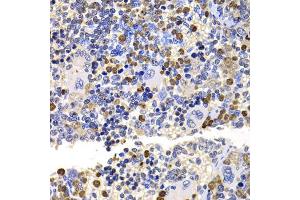 Immunohistochemistry of paraffin-embedded rat spleen using UBE2V2 antibody (ABIN5975744) at dilution of 1/100 (40x lens). (UBE2V2 anticorps)