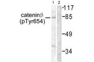 Western blot analysis of extracts from 293 cells, using Catenin-beta (Phospho-Tyr654) Antibody. (beta Catenin anticorps  (pTyr654))