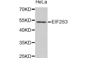 Western blot analysis of extracts of HeLa cell line, using EIF2S3 antibody. (EIF2S3 anticorps)