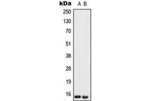 Western blot analysis of Urotensin 2 expression in SKBR3 (A), U251MG (B) whole cell lysates. (Urotensin 2 anticorps  (Center))