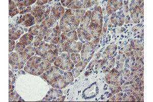 Image no. 4 for anti-RIO Kinase 2 (RIOK2) (AA 277-552) antibody (ABIN1491304) (RIOK2 anticorps  (AA 277-552))