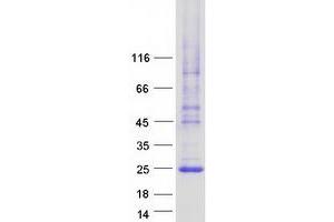 Validation with Western Blot (LHFPL3 Protein (Myc-DYKDDDDK Tag))