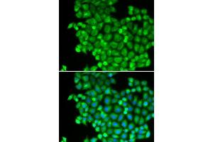 Immunofluorescence analysis of A549 cells using LDHA antibody.