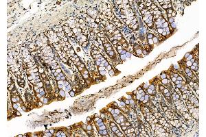 ABIN6264315 and ABIN6276587 at 1/100 staining Rat stomach tissue by IHC-P. (PML anticorps  (N-Term))