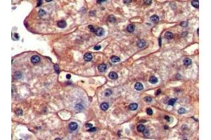 Detection of ICAM1 in Porcine Liver Tissue using Polyclonal Antibody to Intercellular Adhesion Molecule 1 (ICAM1)