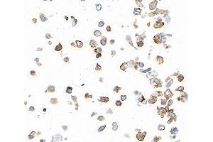 Immunocytochemistry (ICC) image for anti-CD274 (PD-L1) (C-Term) antibody (ABIN7454042) (Recombinant PD-L1 anticorps  (C-Term))