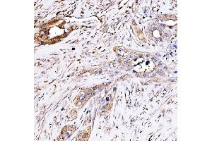 IHC analysis of PAK2 using anti-PAK2 antibody (ABIN7599219). (PAK2 anticorps  (AA 1-288))
