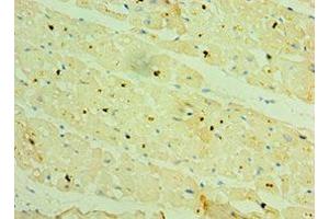 Immunohistochemistry of paraffin-embedded human heart tissue using ABIN7154911 at dilution of 1:100 (HSPB2 anticorps  (AA 1-182))