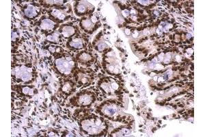 IHC-P Image SNRPA antibody detects SNRPA protein at nucleus on mouse colon by immunohistochemical analysis.