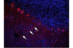 Expression of CXCR4 in rat cerebellum - Immunohistochemical staining of rat cerebellum frozen section using Anti-CXCR4 (extracellular) Antibody (ABIN7043040, ABIN7044166 and ABIN7044167), (1:100).