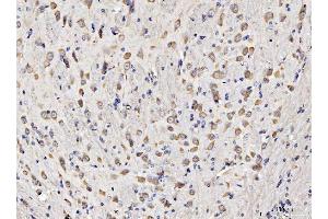 IHC analysis of RPL11 using anti-RPL11 antibody (ABIN7602315). (RPL11 anticorps  (AA 7-178))