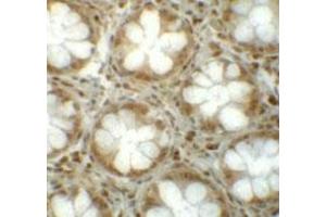 Immunohistochemical staining of human colon cells with LRRFIP1 polyclonal antibody  at 5 ug/mL.