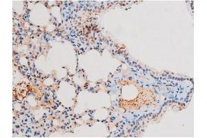 ABIN6267601 at 1/200 staining Mouse lung tissue sections by IHC-P.