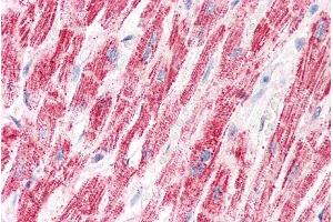 anti-Electron-Transfer-Flavoprotein, alpha Polypeptide (ETFA) (AA 139-152) antibody