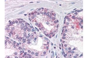 Image no. 1 for anti-phosphodiesterase 11A (PDE11A) (Internal Region) antibody (ABIN372893) (PDE11A anticorps  (Internal Region))
