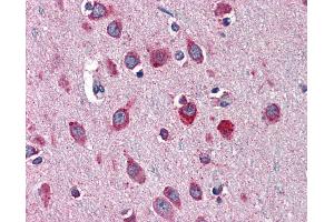 Anti-SERPINI1 / Neuroserpin antibody IHC of human brain, cortex.