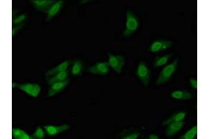 anti-Polymerase (DNA Directed), lambda (POLL) (AA 16-211) antibody