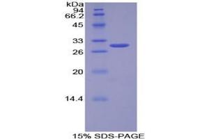 SDS-PAGE analysis of Human Leptin Receptor Protein. (Leptin Receptor Protein (LEPR))