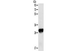 Gel: 8 % SDS-PAGE, Lysate: 50 μg, Lane: Human liver cancer tissue, Primary antibody: ABIN7129664(GSTO1 Antibody) at dilution 1/200, Secondary antibody: Goat anti rabbit IgG at 1/8000 dilution, Exposure time: 20 seconds (GSTO1 anticorps)