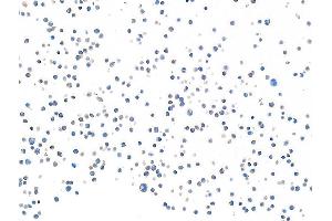 Immunocytochemistry (ICC) image for anti-CD28 (CD28) (AA 170-220) antibody (ABIN7455122) (Recombinant CD28 anticorps  (AA 170-220))