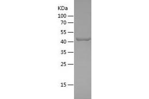 Western Blotting (WB) image for Agrin (AGRN) (AA 1864-2068) protein (His-IF2DI Tag) (ABIN7123658)