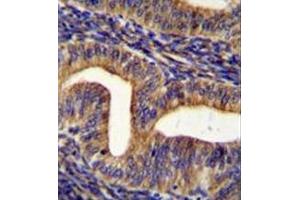 Immunohistochemistry analysis in formalin fixed and paraffin embedded human uterus tissue reacted with Ghrelin receptor / GHSR Antibody (C-term) followed by peroxidase conjugation of the secondary antibody and DAB staining. (GHSR anticorps  (C-Term))